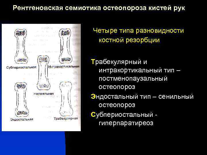 Лучевая анатомия семиотика