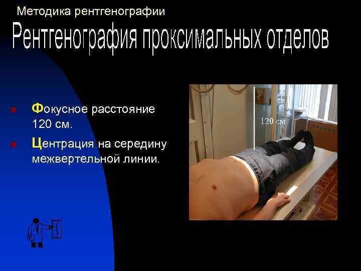 Методика рентгенографии n Фокусное расстояние 120 см. n Центрация на середину межвертельной линии. 120