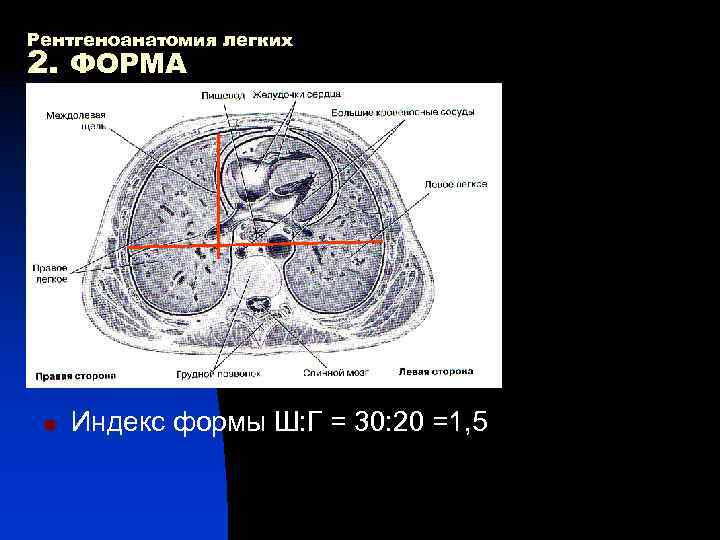 Рентгеноанатомия легких 2. ФОРМА n Индекс формы Ш: Г = 30: 20 =1, 5