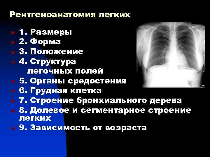 Рентгеноанатомия легких n 1. Размеры n 2. Форма n 3. Положение n 4. Структура