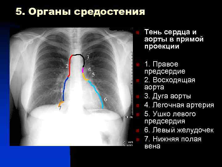 5. Органы средостения n Тень сердца и аорты в прямой проекции 3 2 n