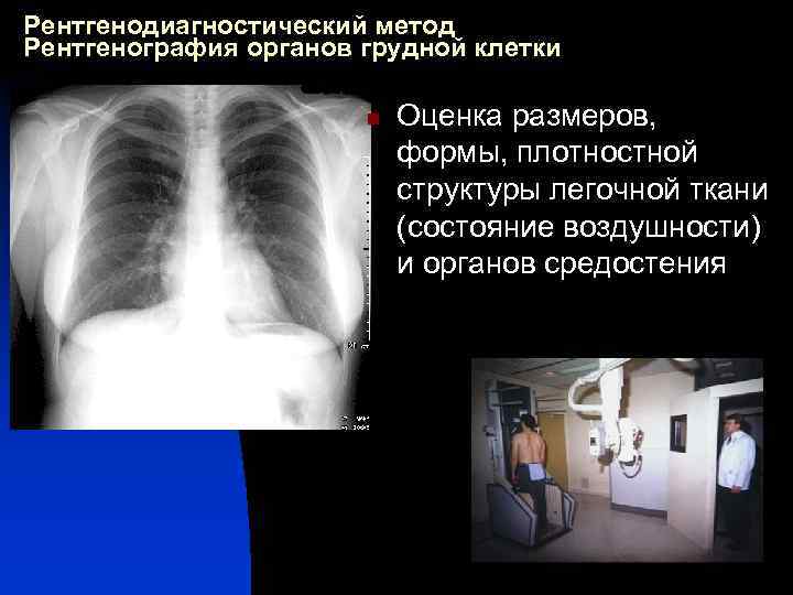 Рентгенодиагностический метод Рентгенография органов грудной клетки n Оценка размеров, формы, плотностной структуры легочной ткани