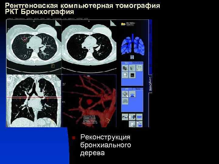 Интерактивная реконструкция кт изображений