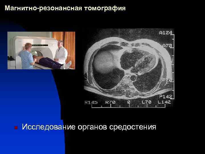 Магнитно-резонансная томография n Исследование органов средостения 