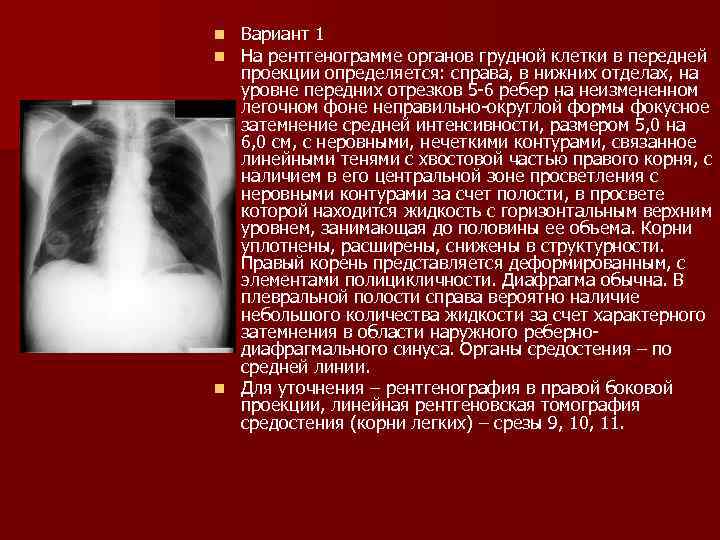 Изображение органов на рентгенограммах является ответ на тест