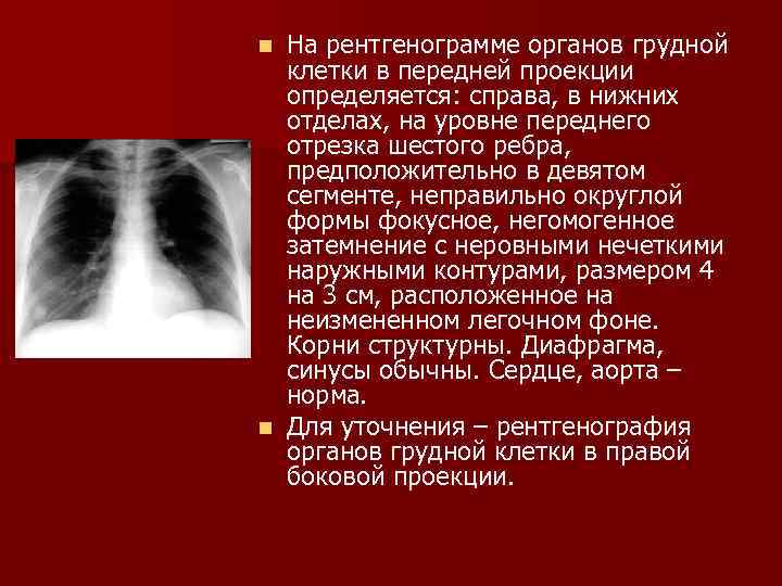 Изображение органов на рентгенограммах является ответ на тест