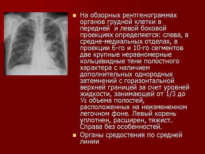 На рисунках представлены рентгенограммы суставов человека какой цифрой отмечена рентгенограмма