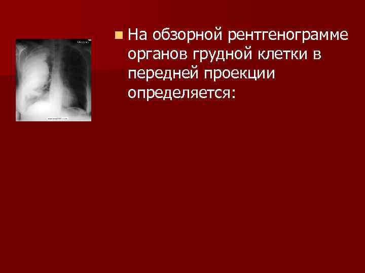 n Наобзорной рентгенограмме органов грудной клетки в передней проекции определяется: 
