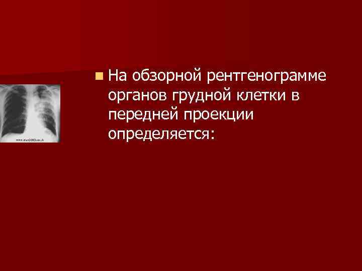 n Наобзорной рентгенограмме органов грудной клетки в передней проекции определяется: 