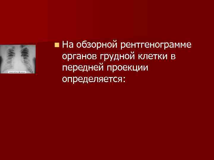 n Наобзорной рентгенограмме органов грудной клетки в передней проекции определяется: 