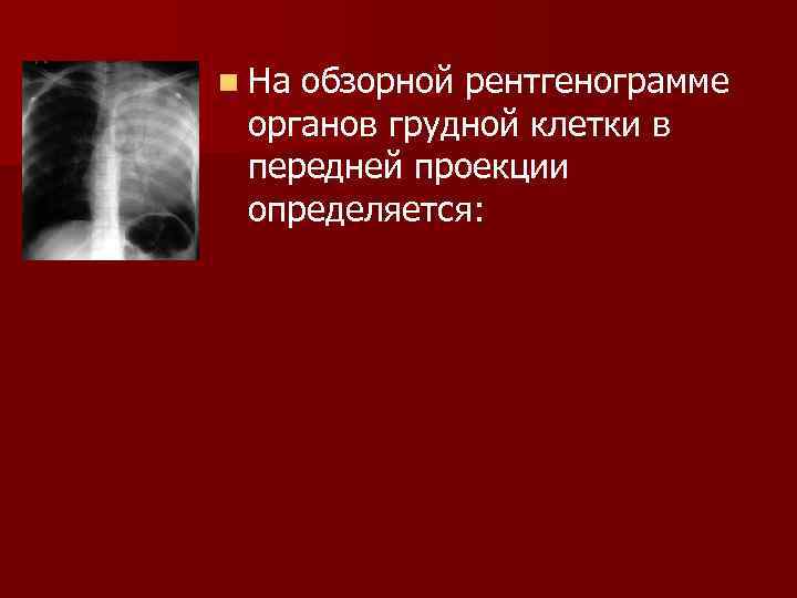 n Наобзорной рентгенограмме органов грудной клетки в передней проекции определяется: 