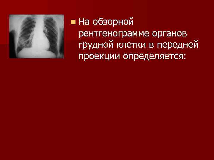 n Наобзорной рентгенограмме органов грудной клетки в передней проекции определяется: 