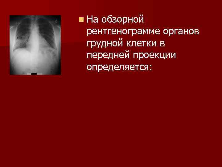 n Наобзорной рентгенограмме органов грудной клетки в передней проекции определяется: 
