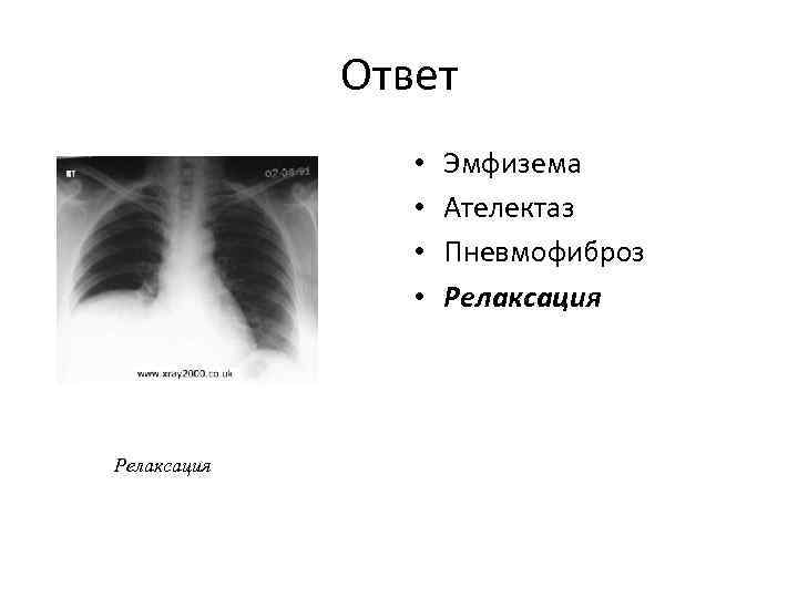 Ответ • • Релаксация Эмфизема Ателектаз Пневмофиброз Релаксация 