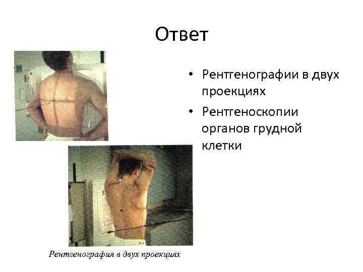 Ответ • Рентгенографии в двух проекциях • Рентгеноскопии органов грудной клетки Рентгенография в двух