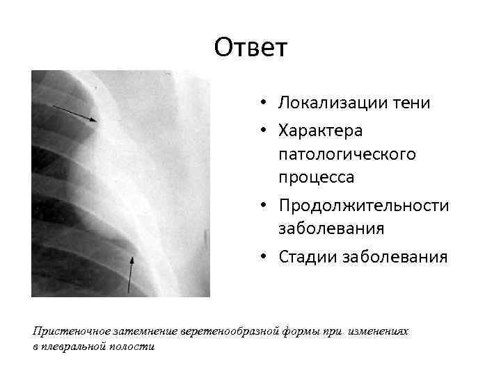 Ответ • Локализации тени • Характера патологического процесса • Продолжительности заболевания • Стадии заболевания