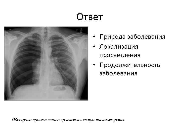 Ответ • Природа заболевания • Локализация просветления • Продолжительность заболевания Обширное пристеночное просветление при
