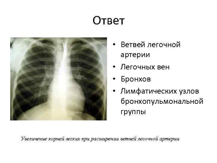 Ответ • Ветвей легочной артерии • Легочных вен • Бронхов • Лимфатических узлов бронхопульмональной