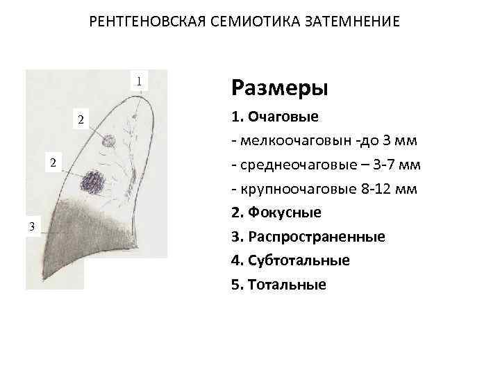 РЕНТГЕНОВСКАЯ СЕМИОТИКА ЗАТЕМНЕНИЕ 1 2 2 3 Размеры 1. Очаговые - мелкоочаговын -до 3