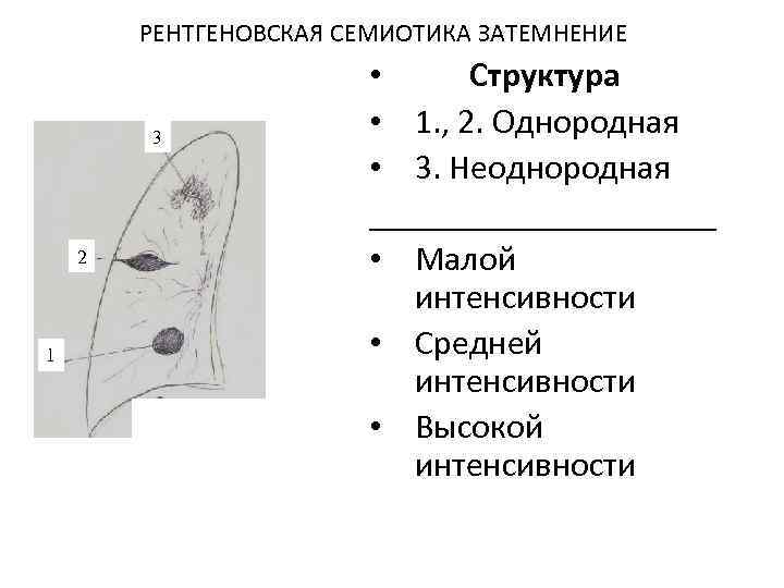 РЕНТГЕНОВСКАЯ СЕМИОТИКА ЗАТЕМНЕНИЕ 3 2 1 • Структура • 1. , 2. Однородная •