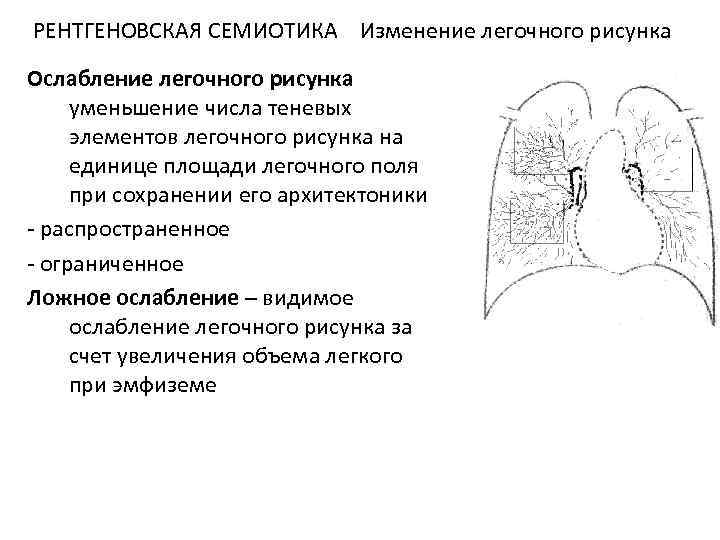 Отделы легочного рисунка. Патология изменения легочного рисунка. Легочный рисунок. Ослабление легочного рисунка. Легочный рисунок Изменен.