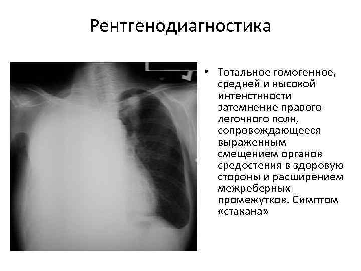 Рентгенодиагностика   • Тотальное гомогенное,    средней и высокой  