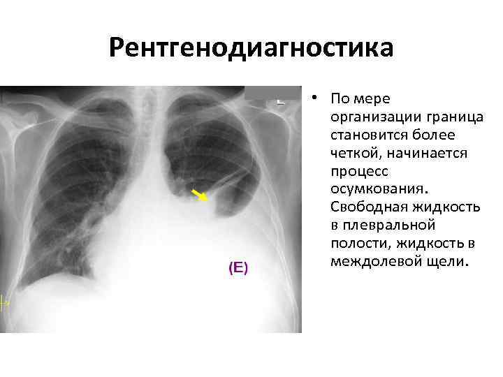 Рентгенодиагностика    • По мере    организации граница  