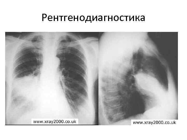 Рентгенодиагностика 