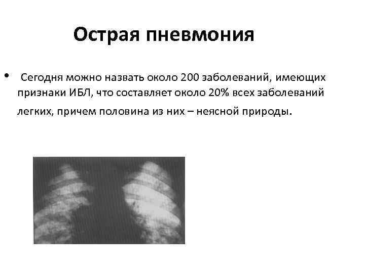   Острая пневмония •  Сегодня можно назвать около 200 заболеваний, имеющих 