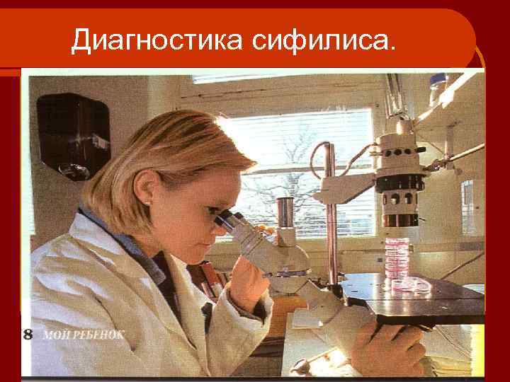 Диагностика сифилиса. 