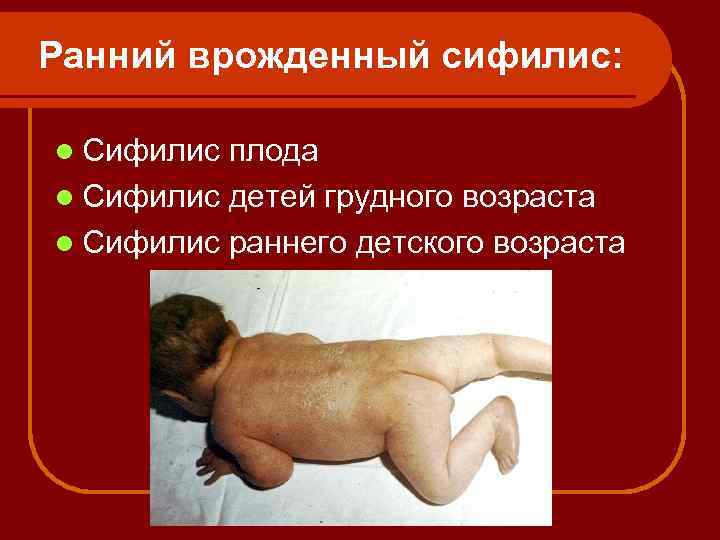 Ранний врожденный сифилис: l Сифилис плода l Сифилис детей грудного возраста l Сифилис раннего