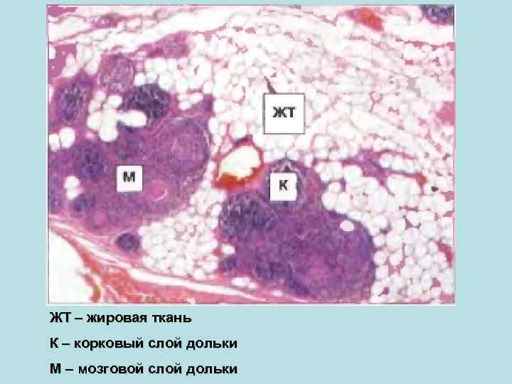 ЖТ – жировая ткань К – корковый слой дольки М – мозговой слой дольки
