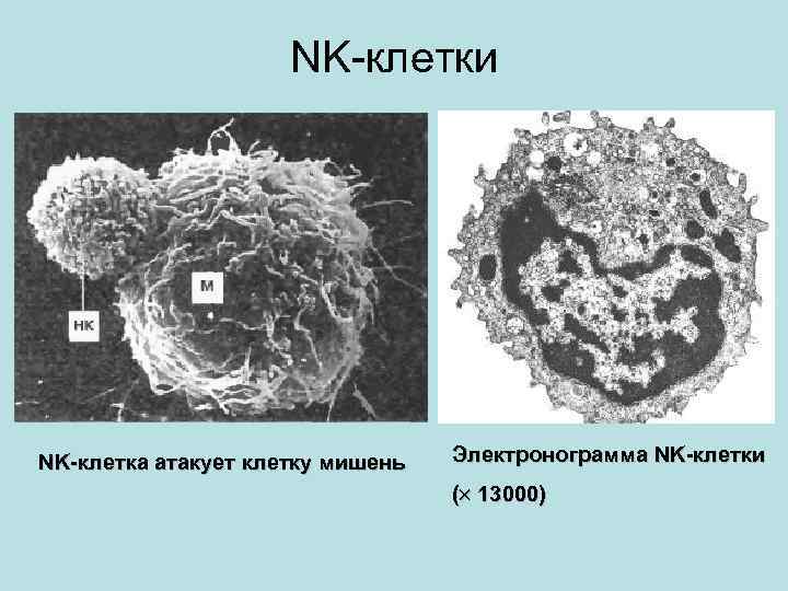 NK-клетки NK-клетка атакует клетку мишень Электронограмма NK-клетки ( 13000) 