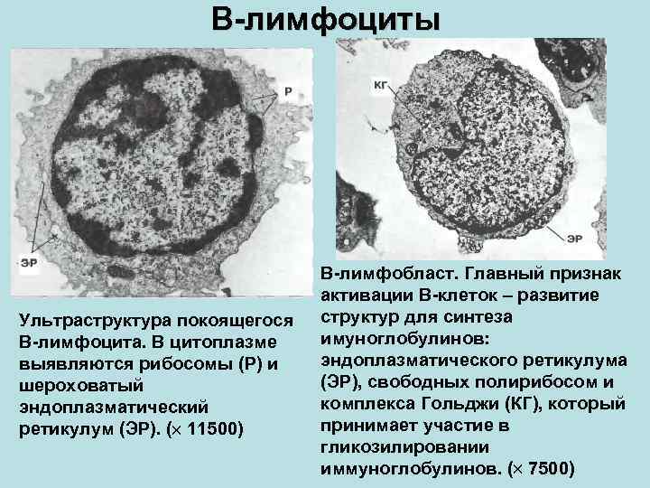 В-лимфоциты Ультраструктура покоящегося В-лимфоцита. В цитоплазме выявляются рибосомы (Р) и шероховатый эндоплазматический ретикулум (ЭР).