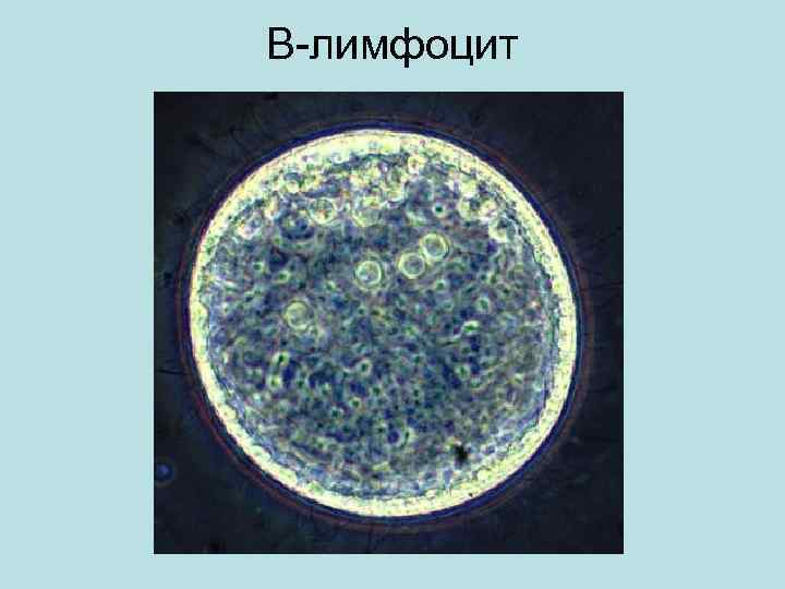 В-лимфоцит 