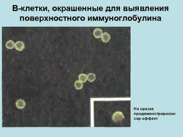 В-клетки, окрашенные для выявления поверхностного иммуноглобулина На врезке продемонстрирован cap-эффект 