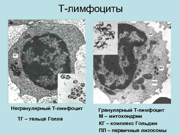 Т-лимфоциты Негранулярный Т-лимфоцит ТГ – тельце Голла Гранулярный Т-лимфоцит М – митохондрии КГ –