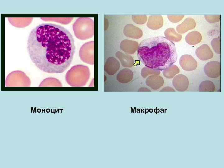 Картинки моноциты под микроскопом