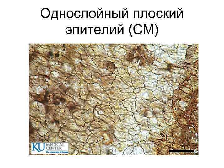Однослойный плоский  эпителий (СМ) 