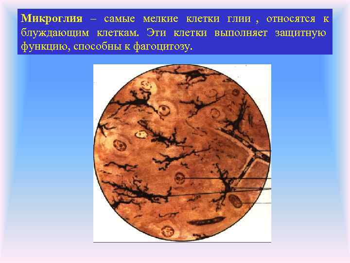 Микроглия – самые мелкие клетки глии , относятся к блуждающим клеткам. Эти клетки выполняет