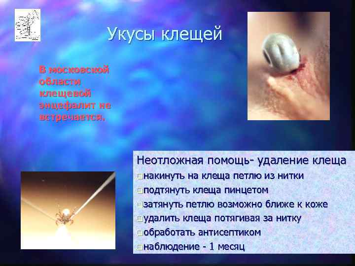   Укусы клещей В московской области клещевой энцефалит не встречается.   