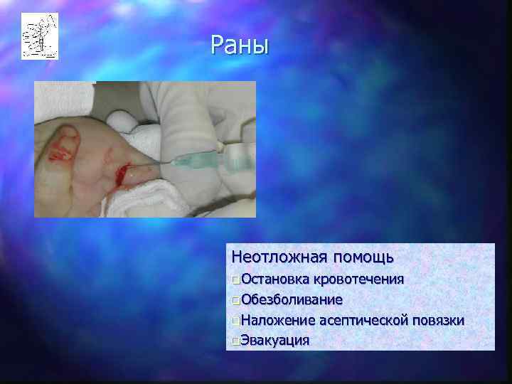 Раны Неотложная помощь q. Остановка кровотечения q. Обезболивание q. Наложение асептической повязки q. Эвакуация