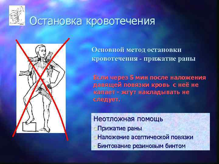 Остановка кровотечения  Основной метод остановки  кровотечения - прижатие раны   Если