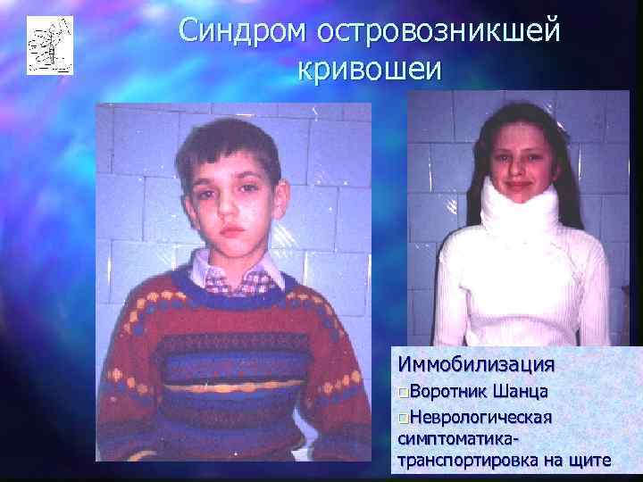 Синдром островозникшей  кривошеи   Иммобилизация   q. Воротник Шанца  