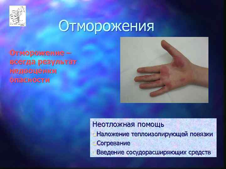   Отморожения Отморожение – всегда результат недооценки опасности    Неотложная помощь