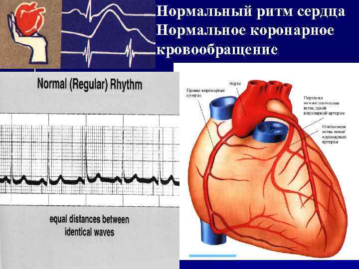 Нормальный ритм сердца Нормальное коронарное кровообращение 