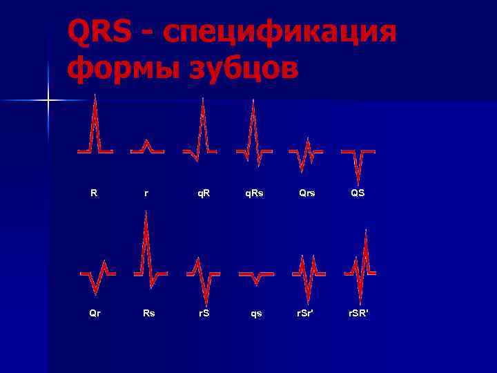 QRS - спецификация формы зубцов R r q. Rs Qrs QS Qr Rs r.