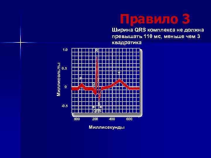 Правило 3 Ширина QRS комплекса не должна превышать 110 мс, меньше чем 3 квадратика