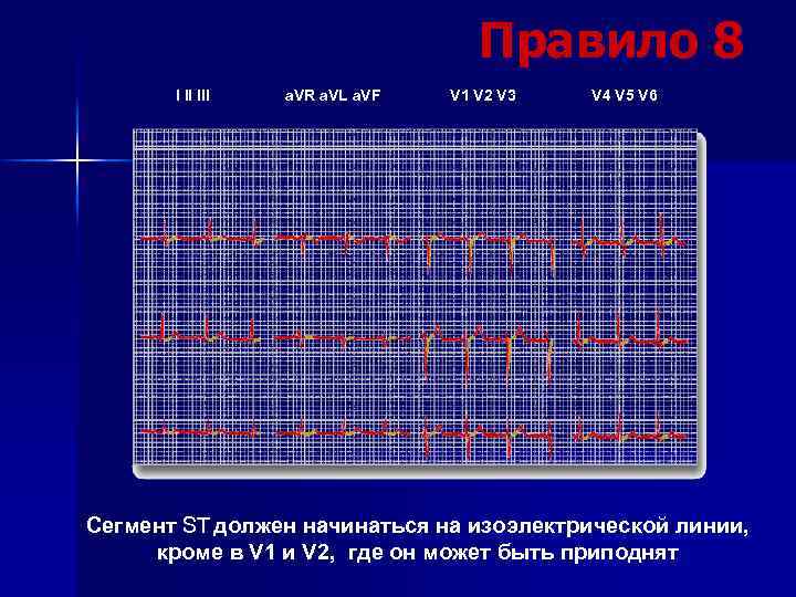 Правило 8 I II III a. VR a. VL a. VF V 1 V