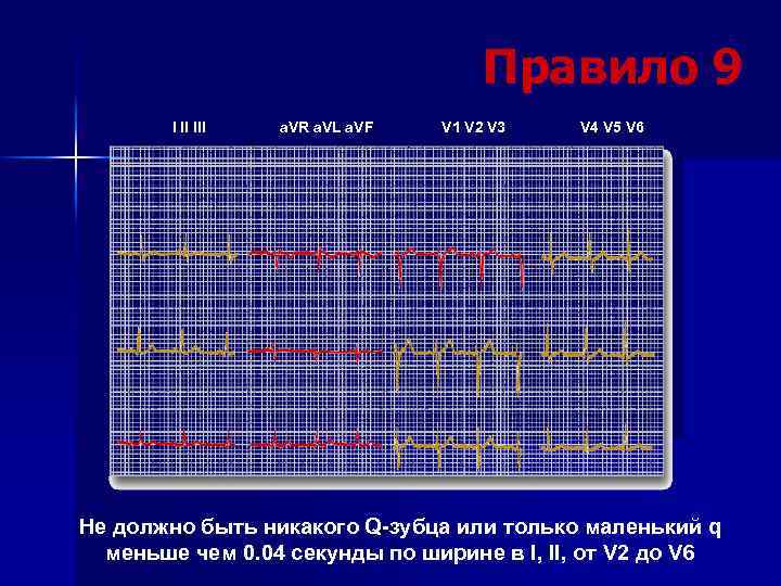 Правило 9 I II III a. VR a. VL a. VF V 1 V